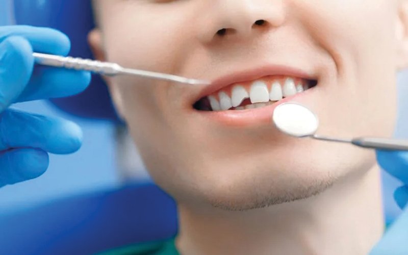 Cosmetic-Dentistry-in-Canton MA
