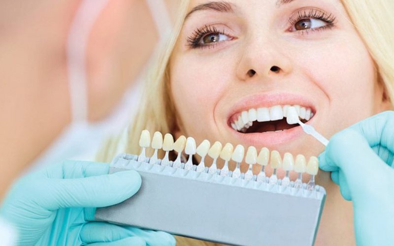 Cosmetic Dentistry