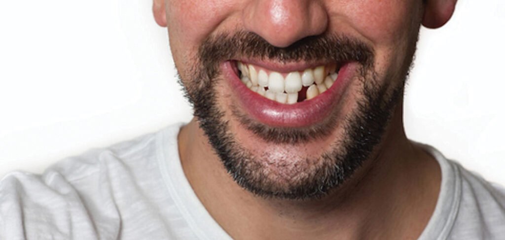 Dental Emergency