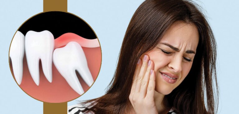 Woman experiencing wisdom tooth pain relief