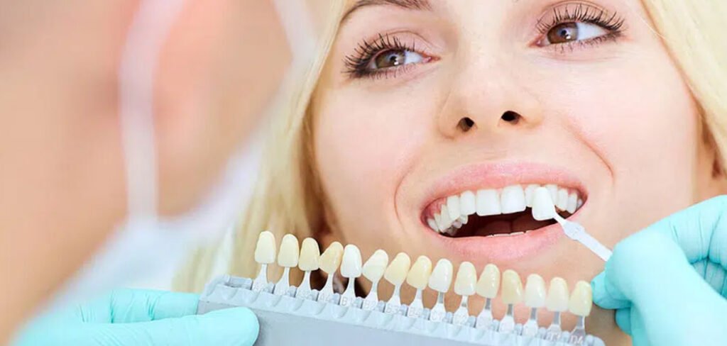 price of dental cap treatment
