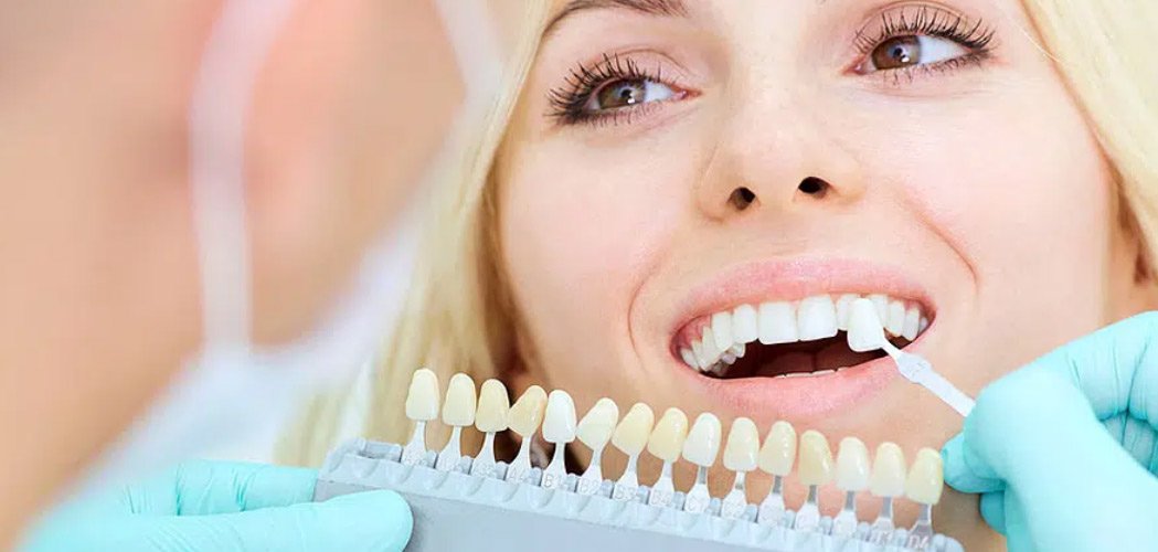 price of dental cap treatment