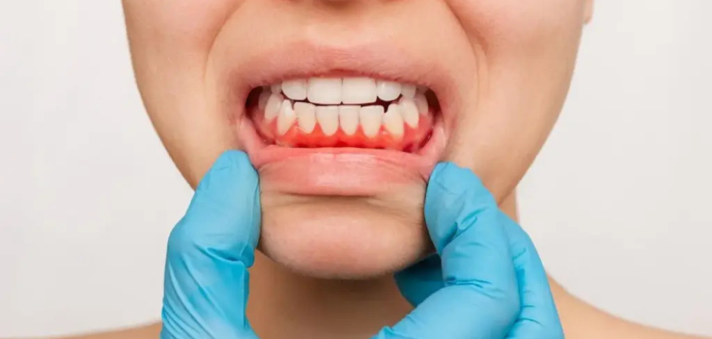 gums red and sore