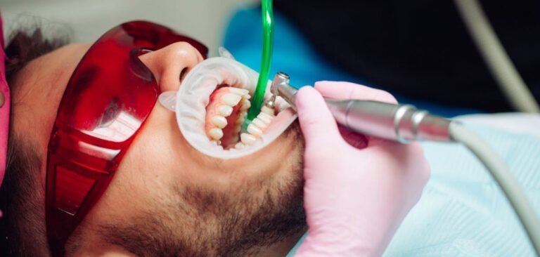 dental prophylaxis